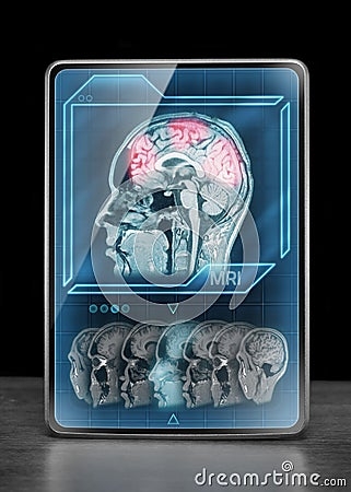Brain Activity Scan Stock Image CartoonDealer 134468443