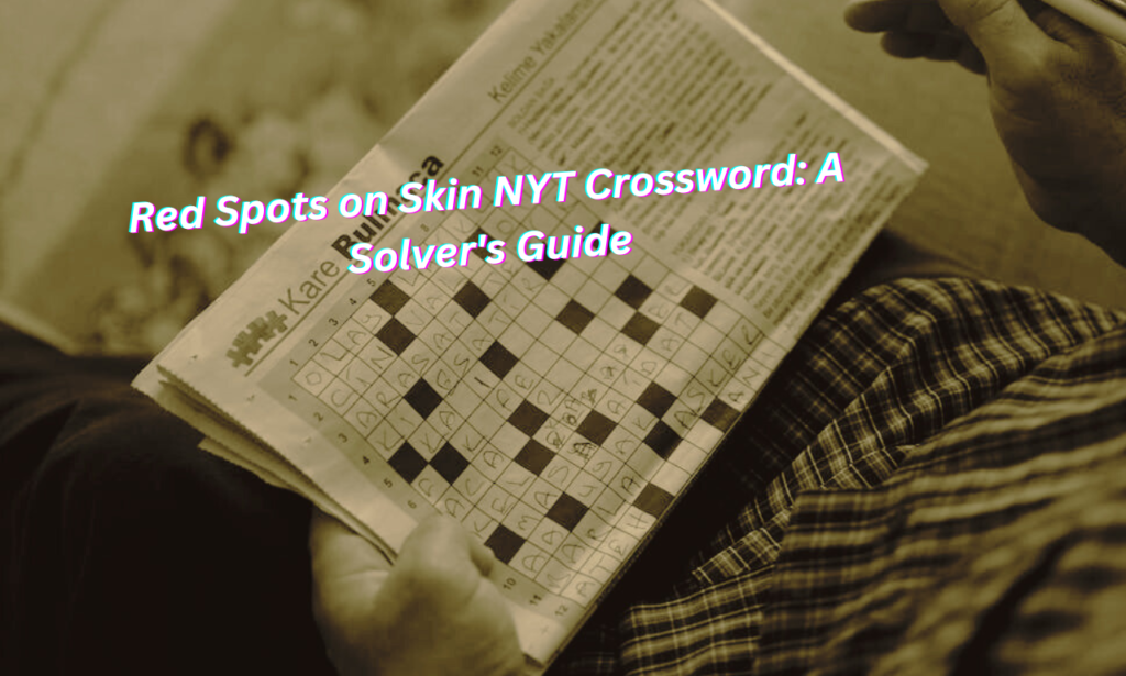 Red Spots On Skin NYT Crossword A Solver s Guide